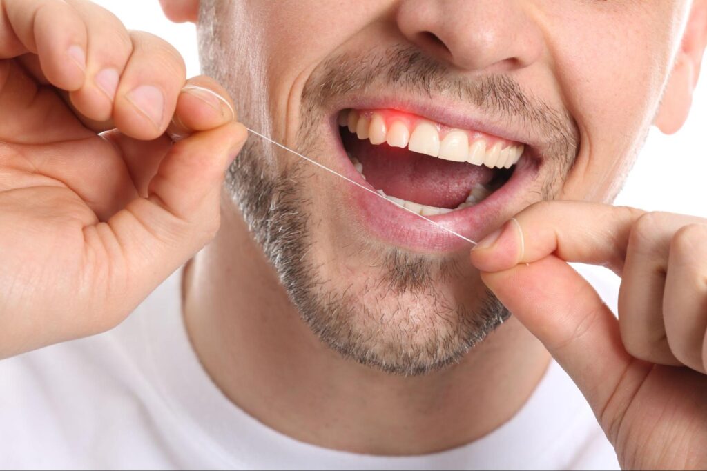5 Reasons Why Gums Bleed When Flossing